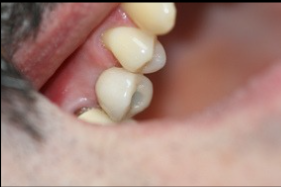 Cas 1 – résultat final