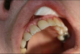 Cas 2 – résultat final