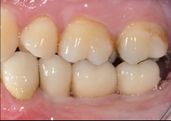 Cas 3 – résultat final