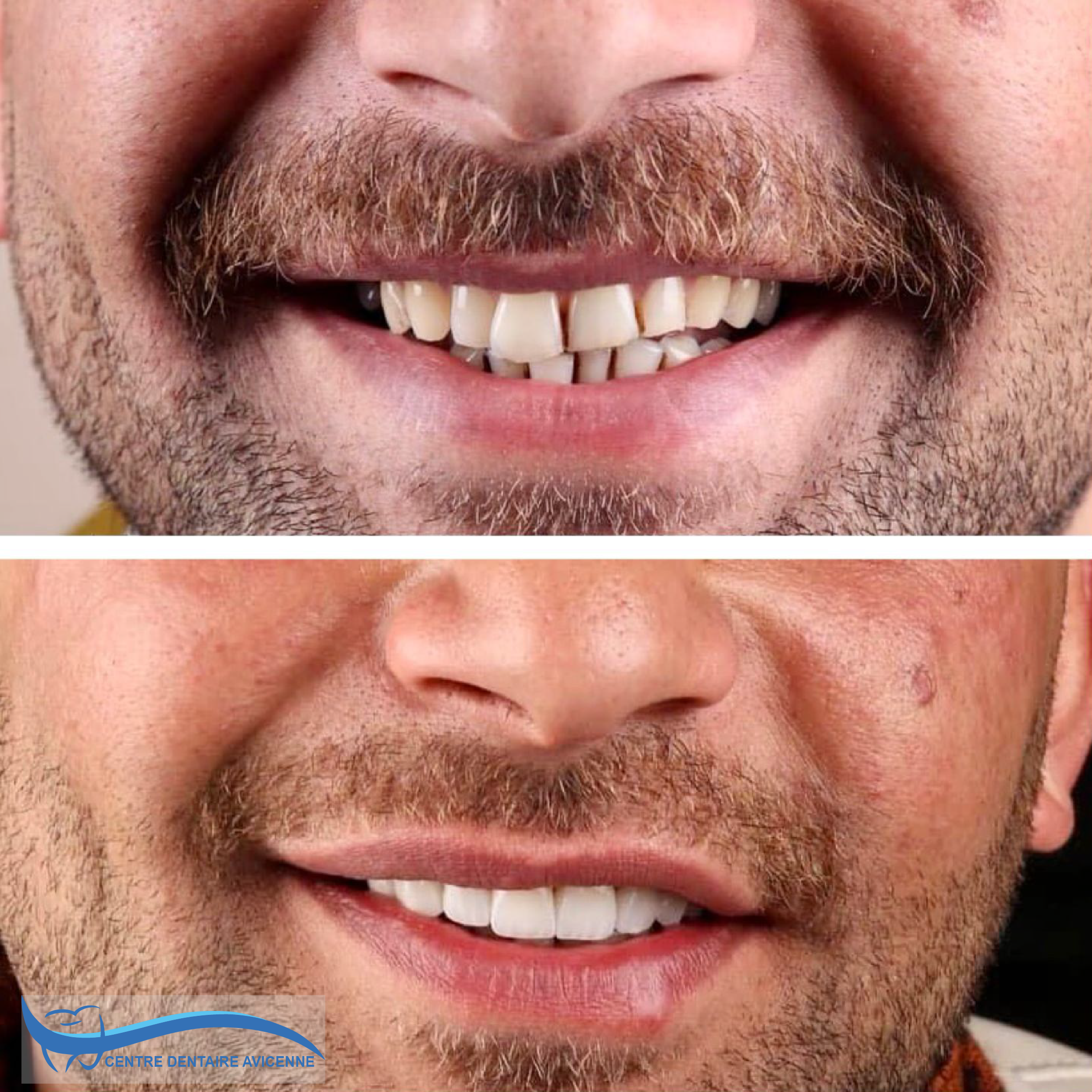 Clinic Dentaire Avicenne