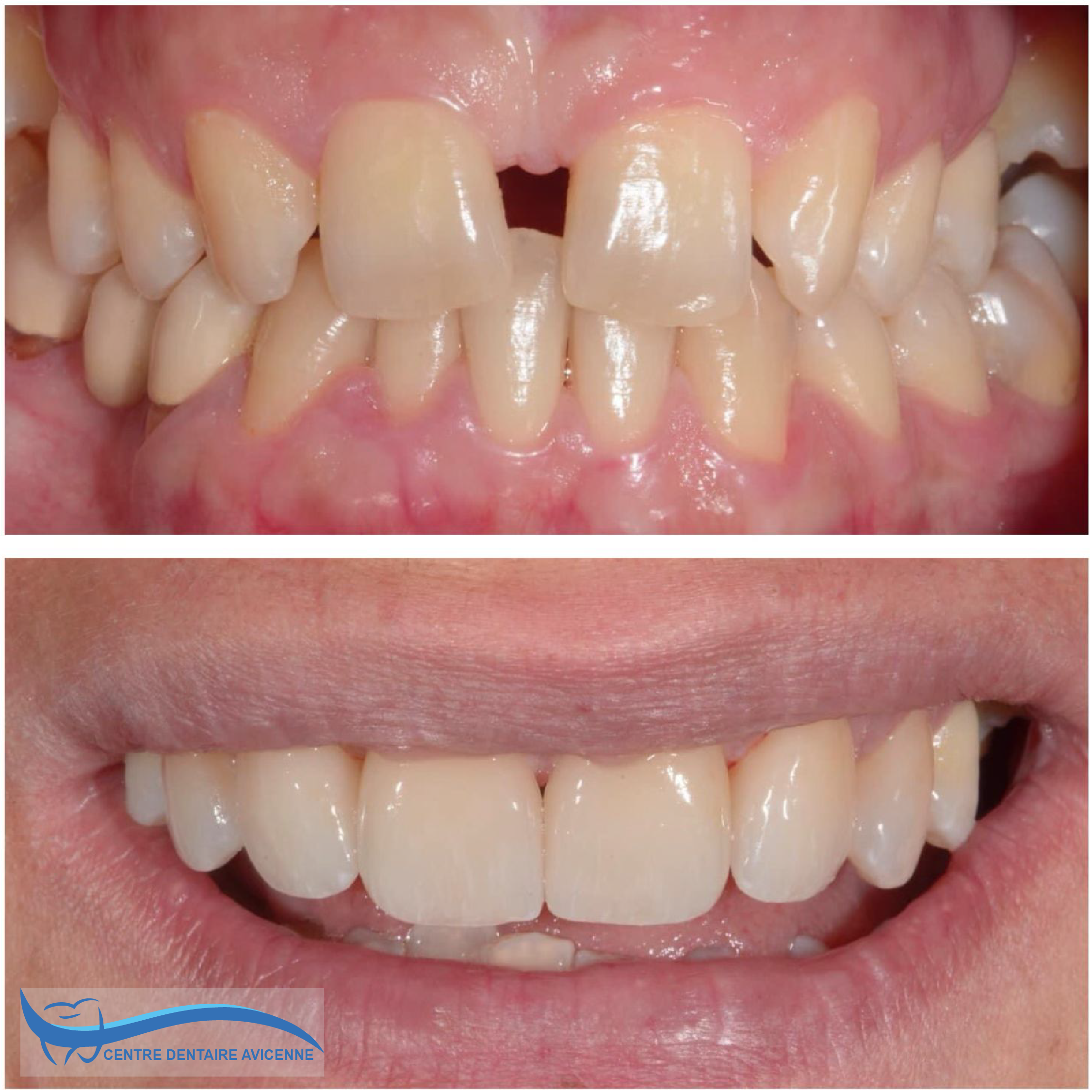 Clinic Dentaire Avicenne
