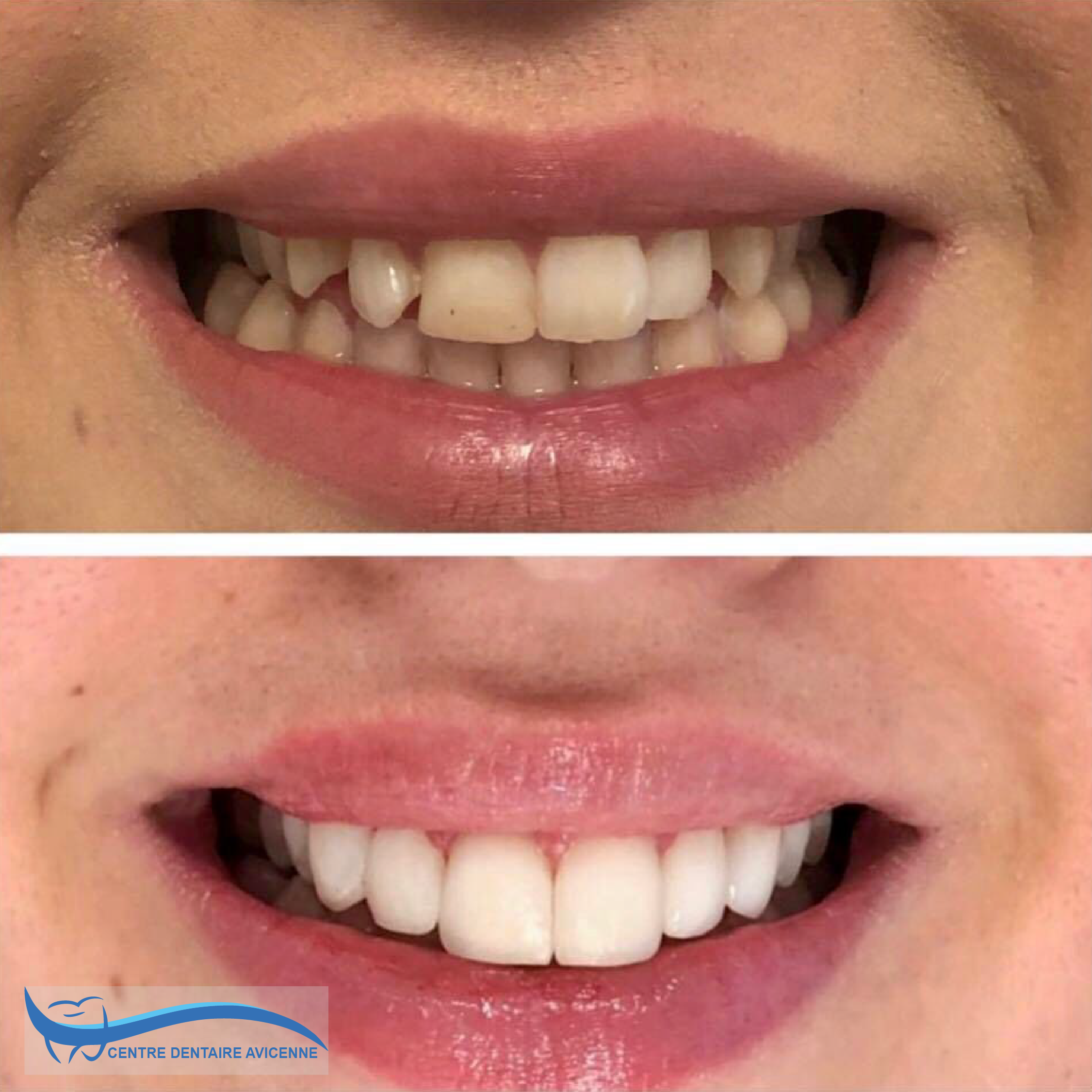 Clinic Dentaire Avicenne