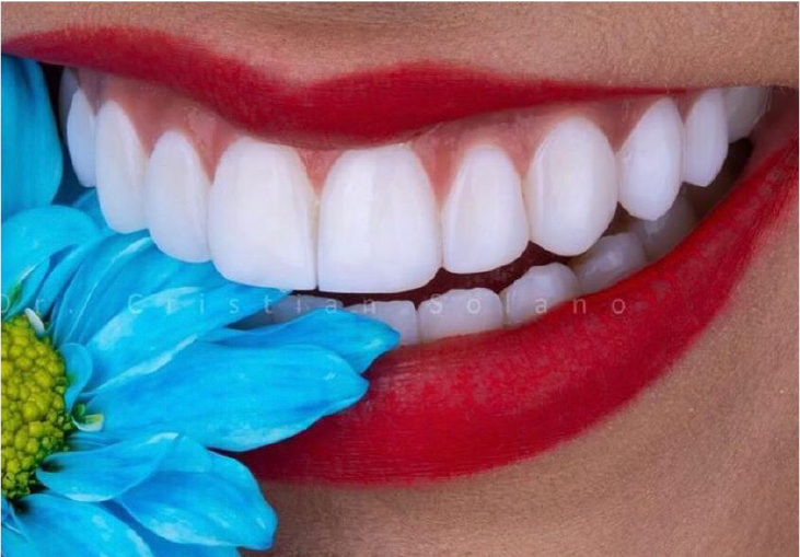 Couronnes en zircone